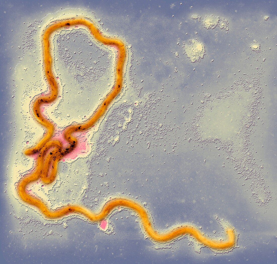 Syphilis bacterium,TEM