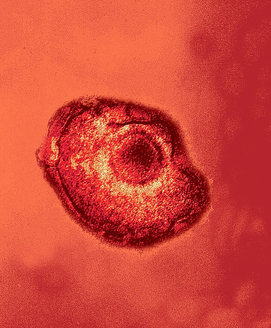 Varicella zoster virus particle,TEM
