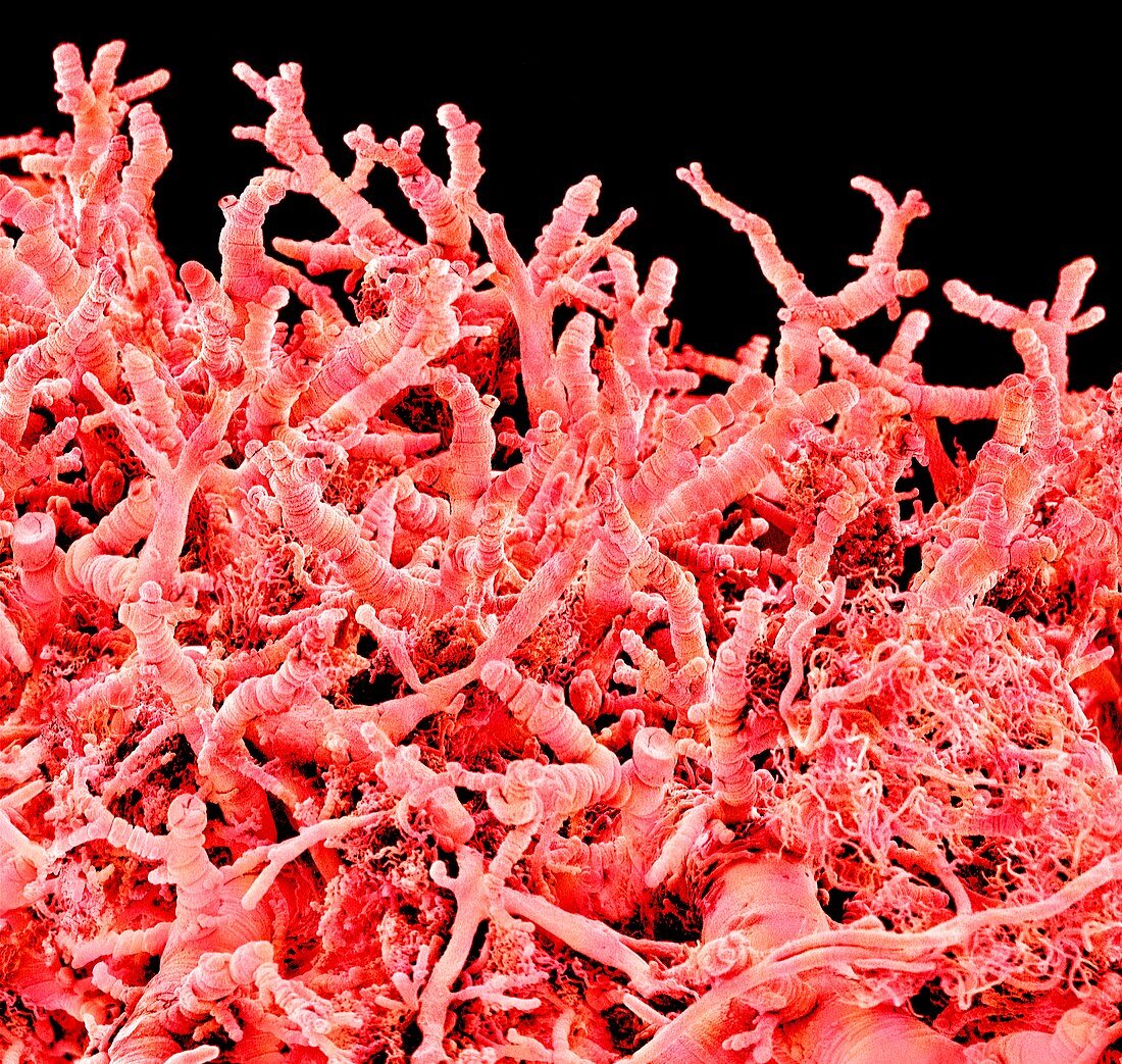 Lung blood vessels,SEM