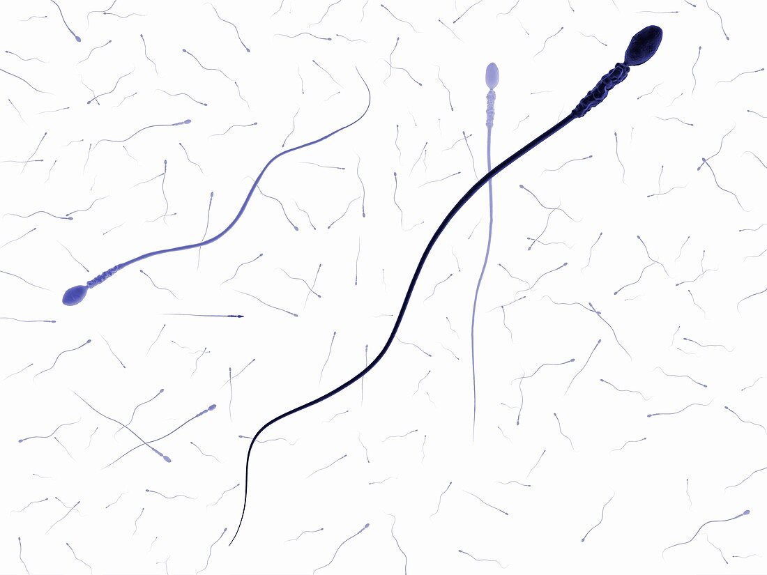 Human sperm,artwork