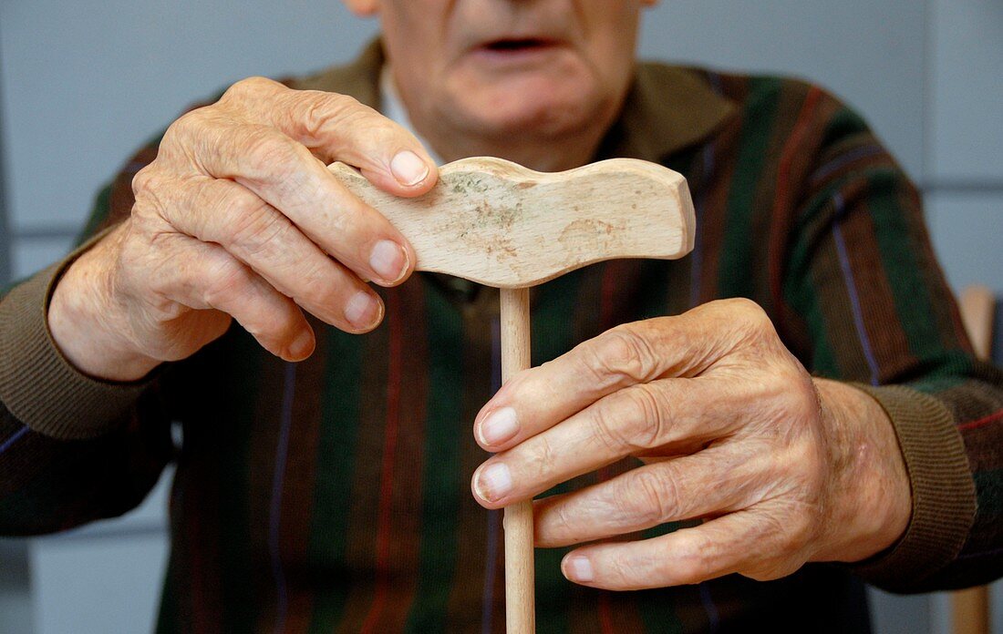 Alzheimer's patient tests hand dexterity