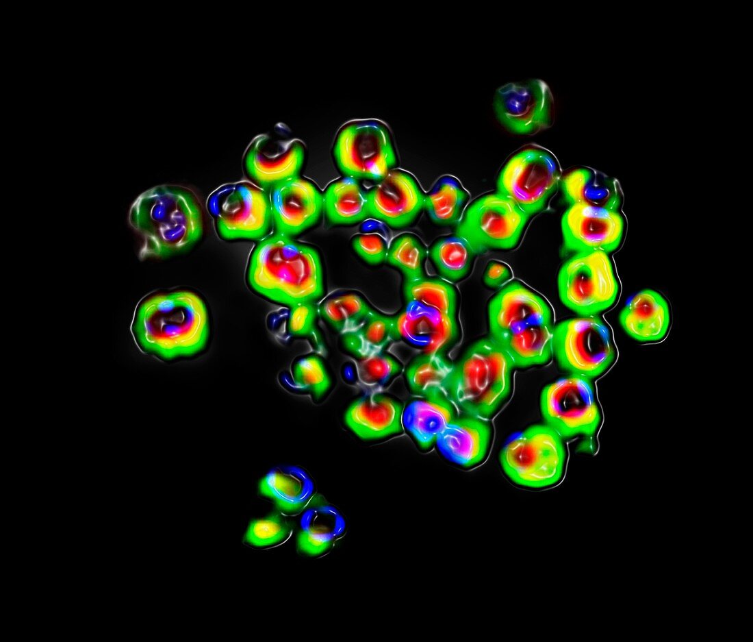 E. coli bacteria,fluorescent micrograph