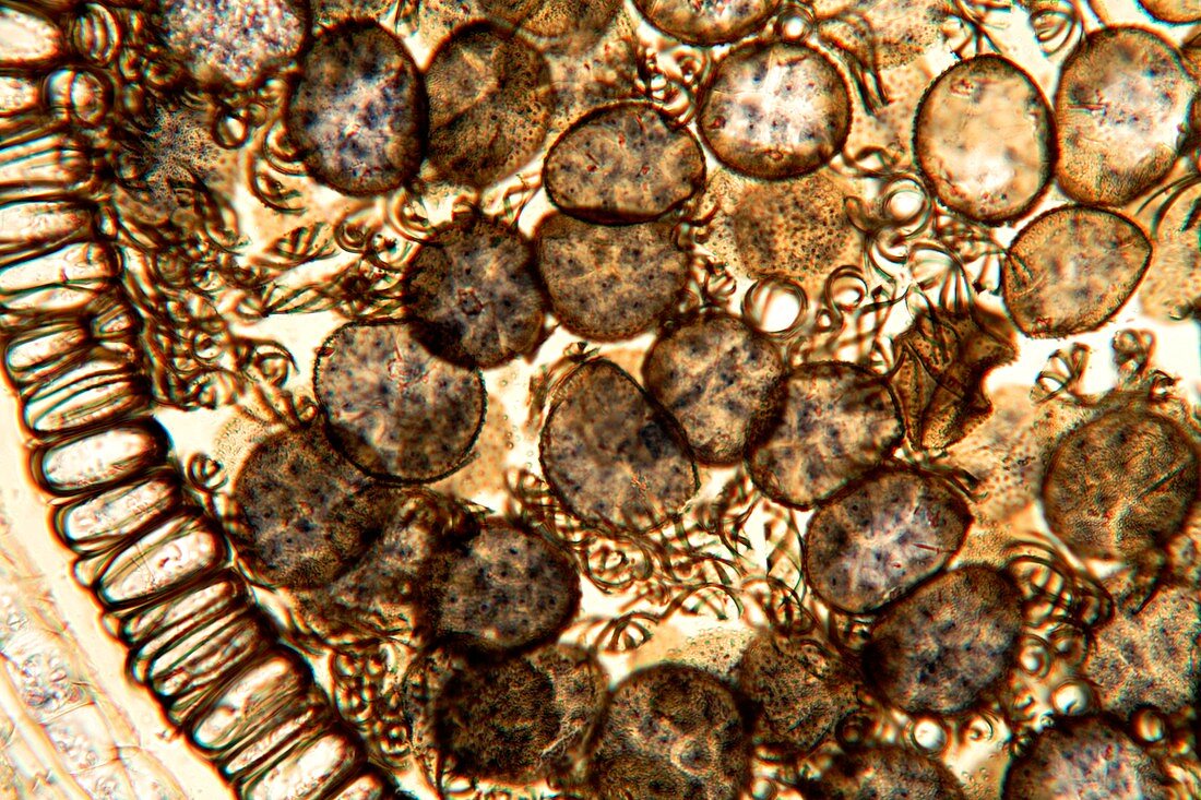 Liverwort spores,light micrograph