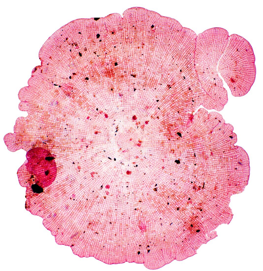 Algal colony,light micrograph