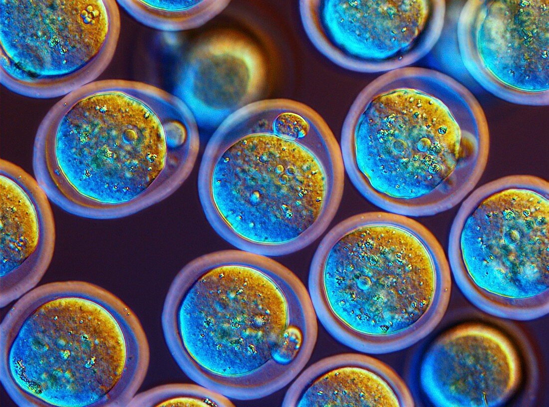 Pronuclear egg cells,light micrograph