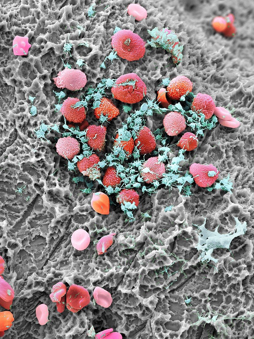 Blood clot formation,SEM