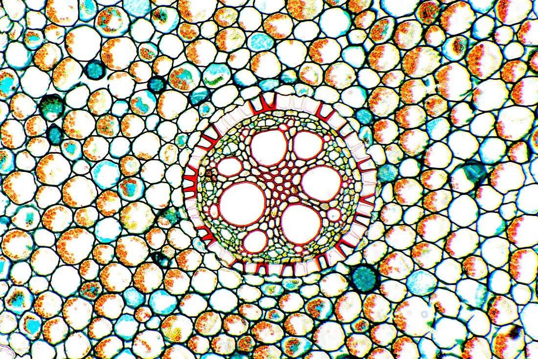 Iris root,light micrograph