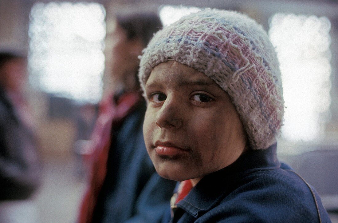 Street child,Romania