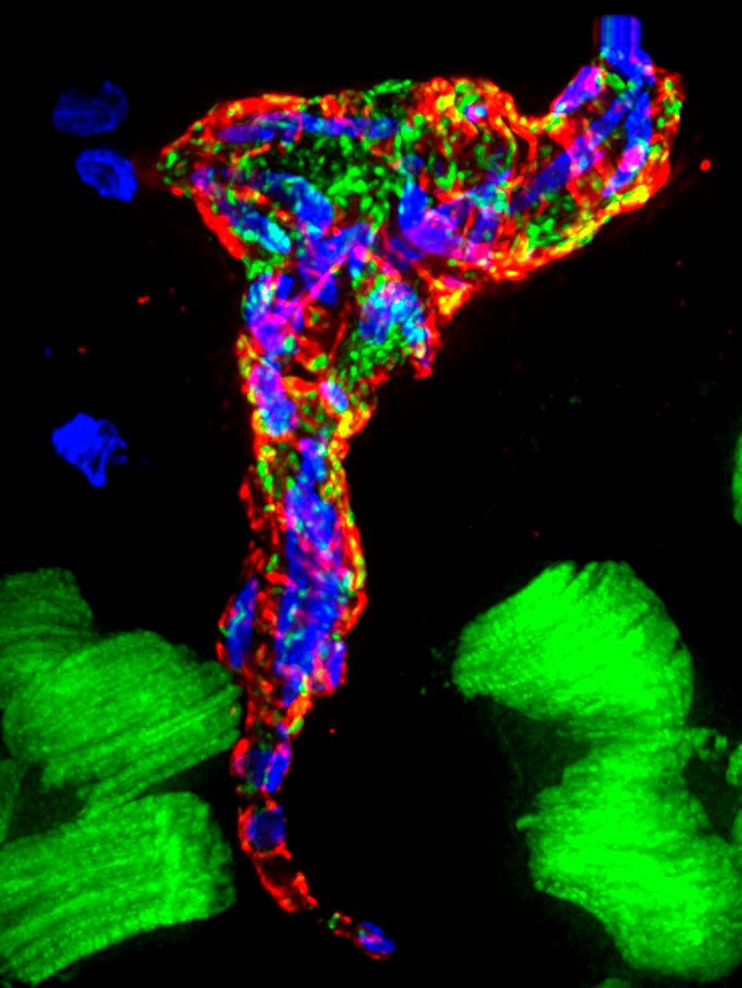 Heart failure,fluorescent micrograph