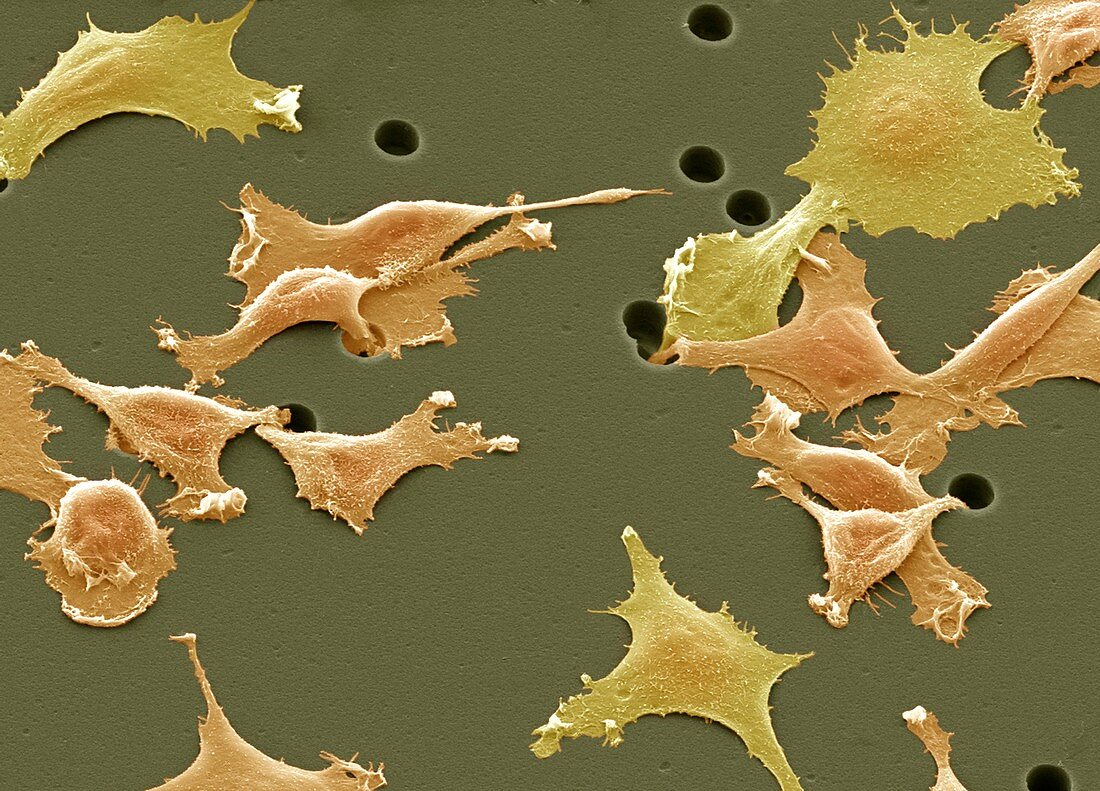 Cancer cell culture,SEM