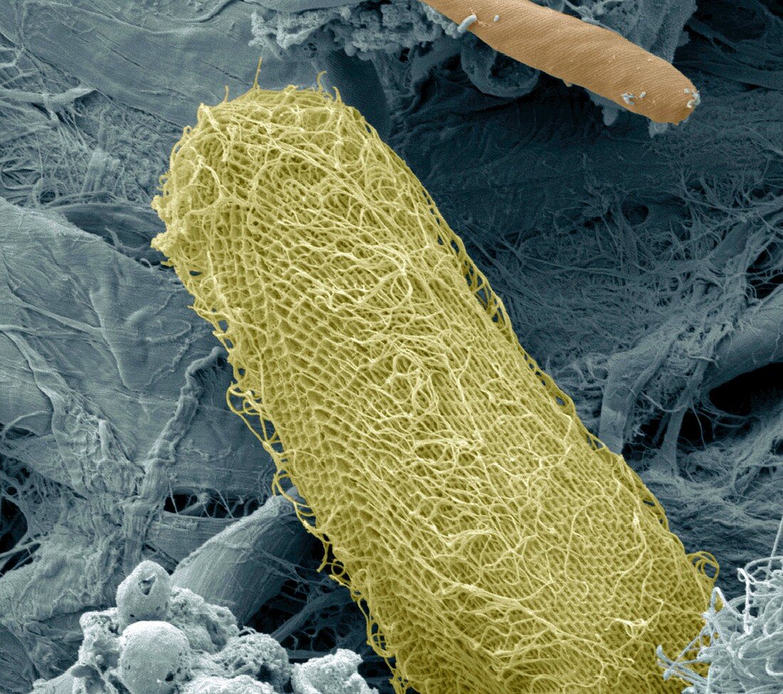 Ciliate protozoan,SEM