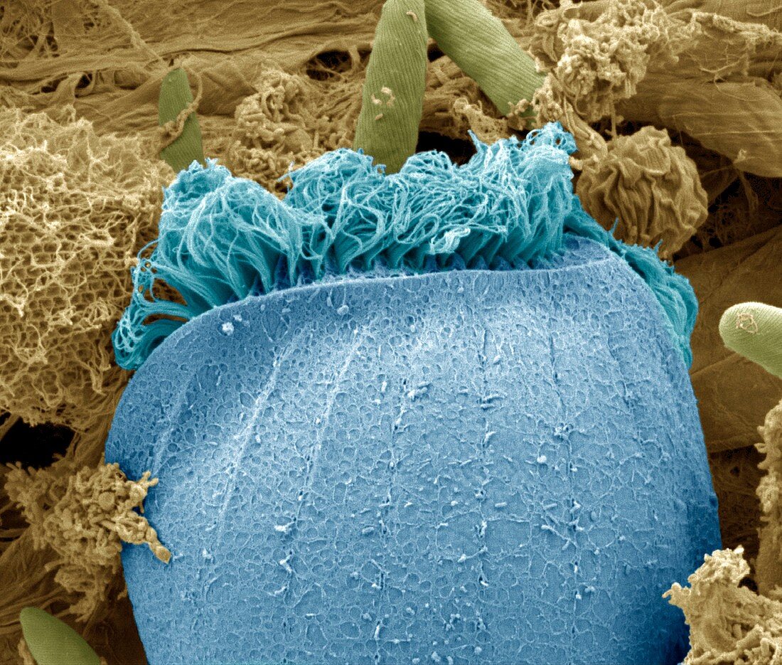 Ciliate protozoan membranelles,SEM