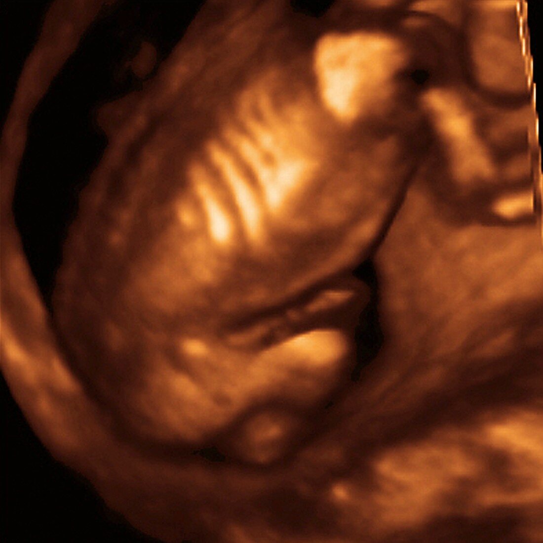 Foetus' back,3-D ultrasound scan