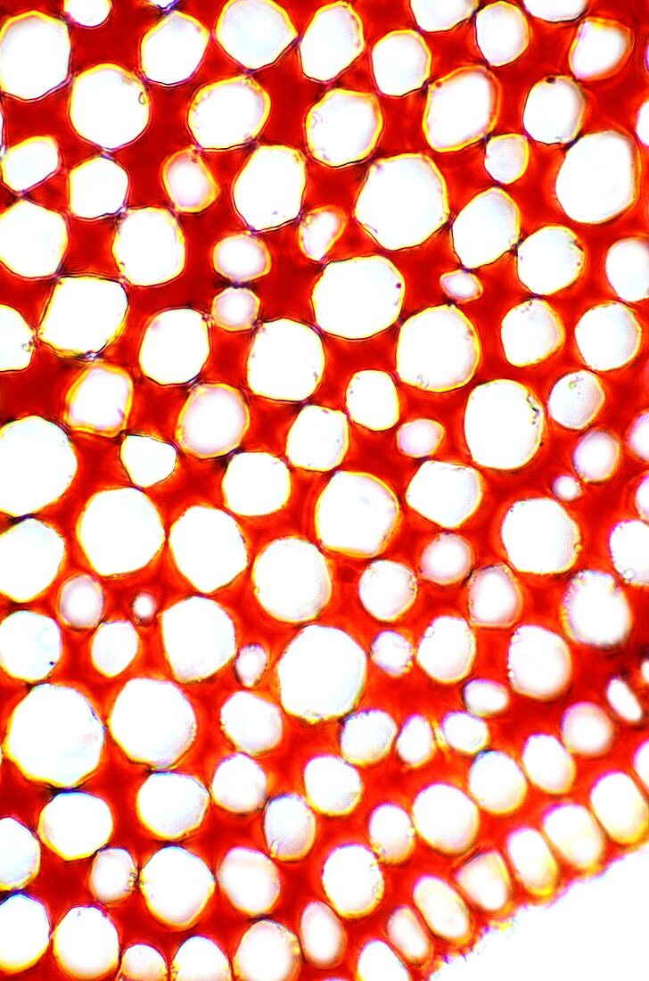 Collenchyma plant cells,light micrograph