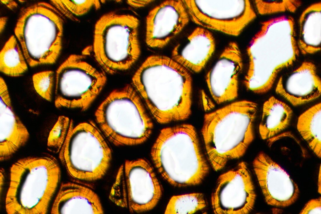 Plasmodesma plant cells,light micrograph