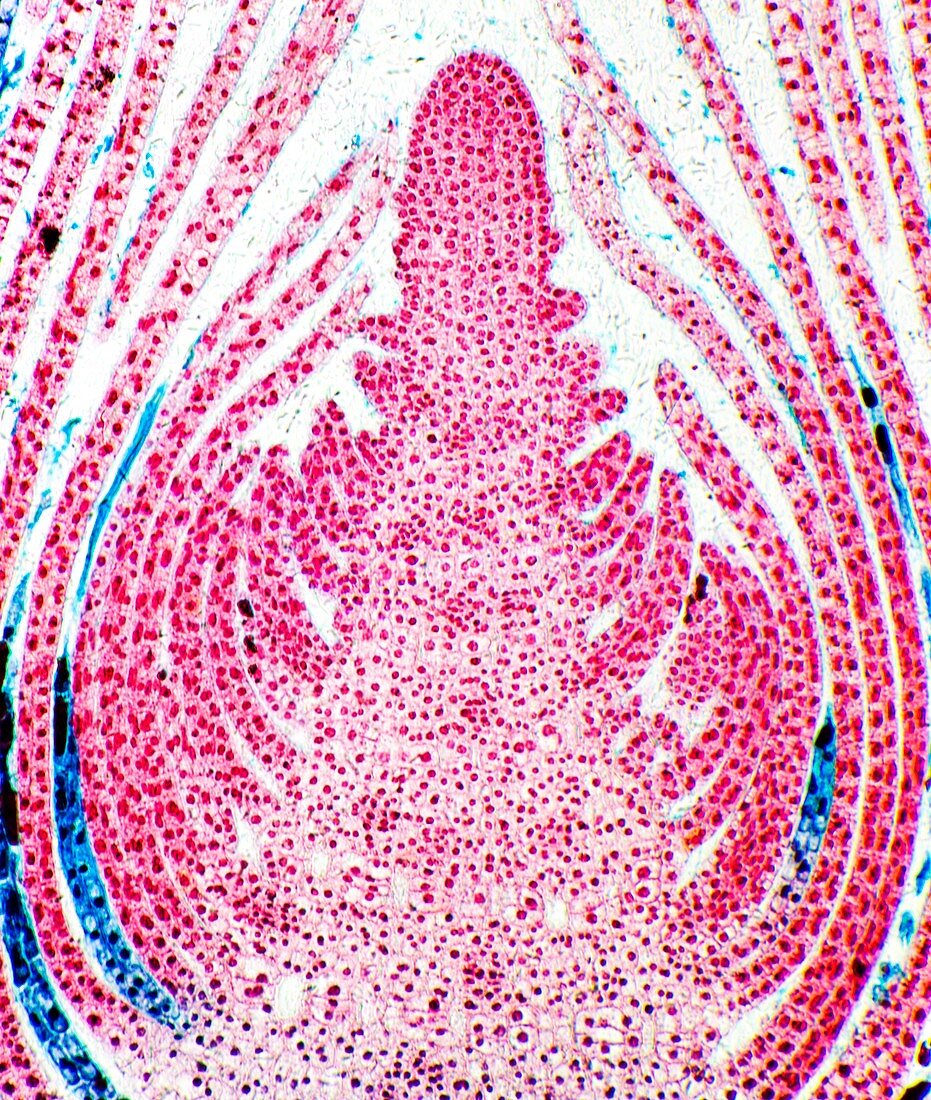 Huckleberry shoot,light micrograph