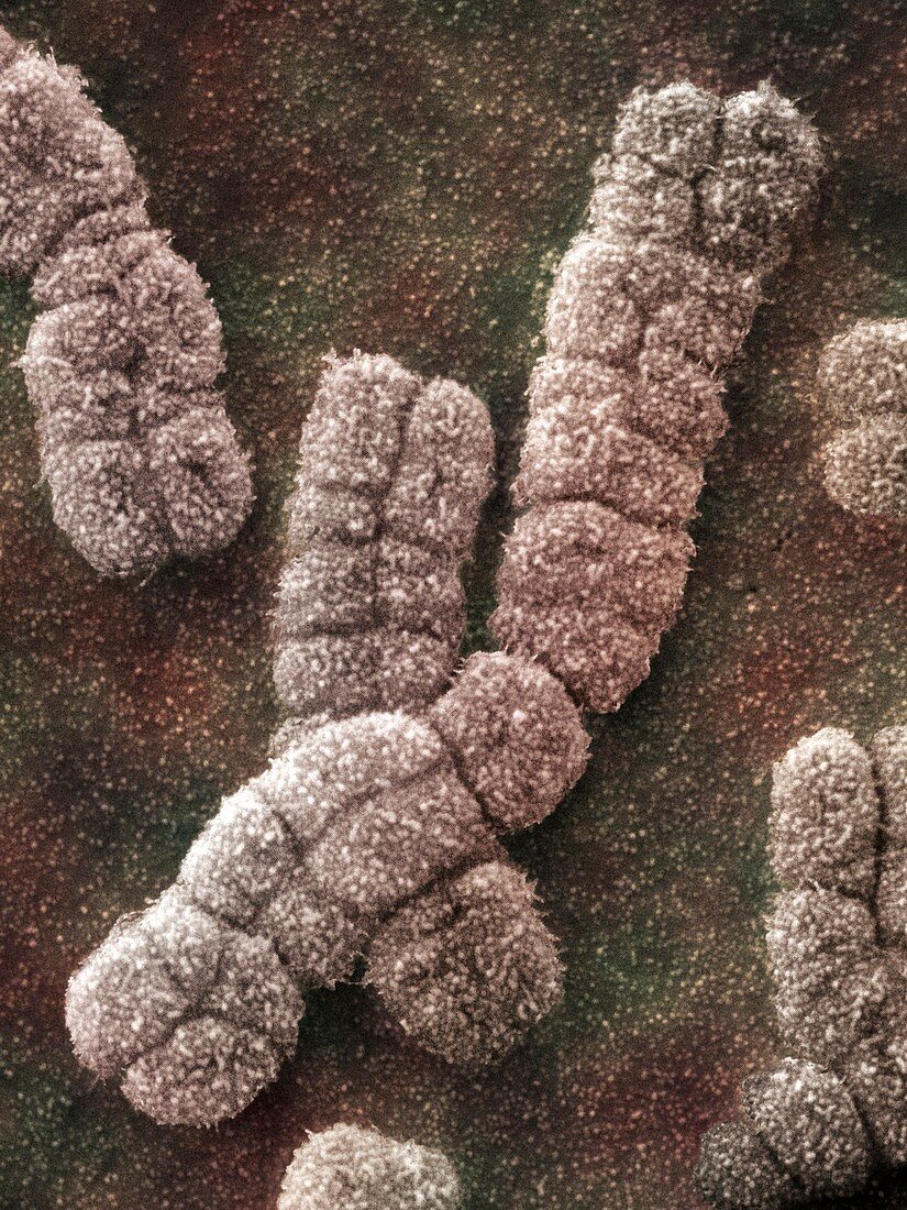 Human chromosomes