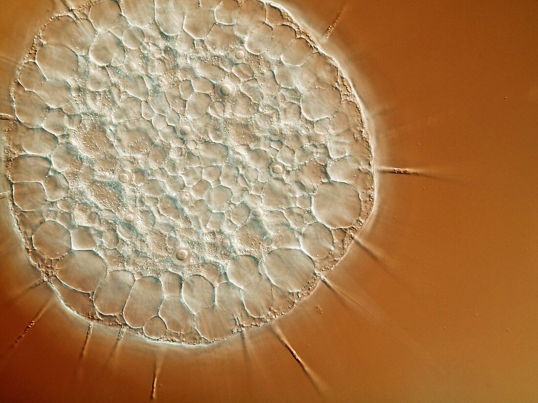 Actinosphaerium protozoan