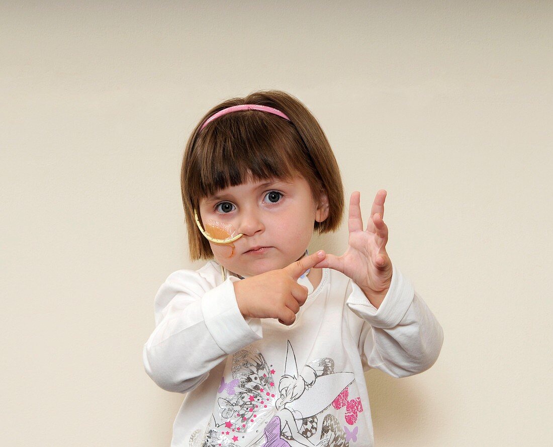 Child with nasogastric tube signing A