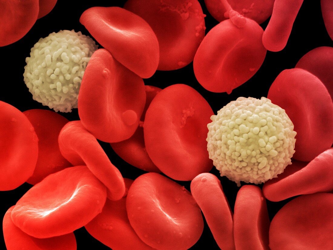 Red and white blood cells,SEM