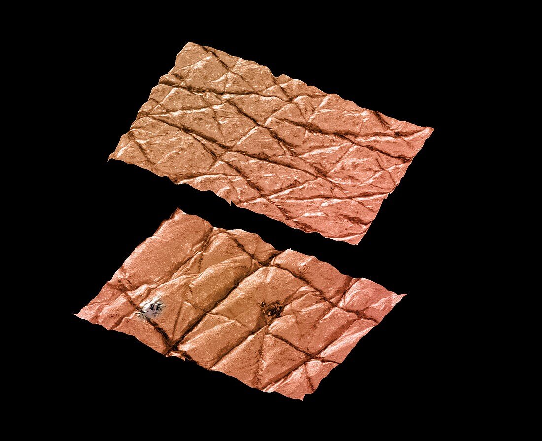 Skin surface comparison