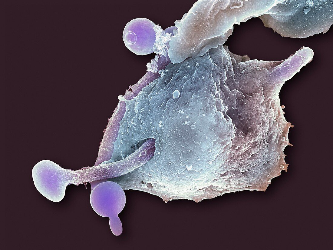 Neutrophil engulfing thrush fungus,SEM