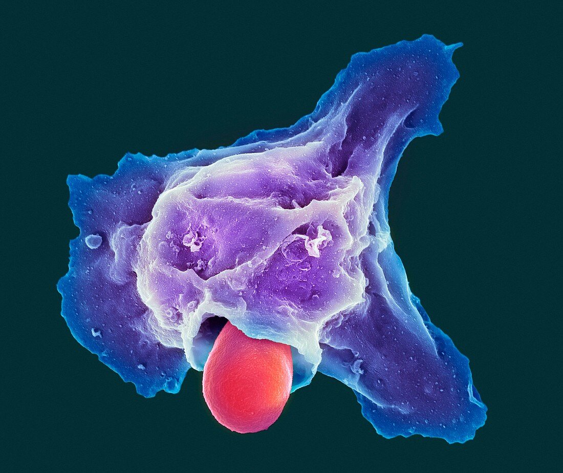 Neutrophil engulfing thrush fungus,SEM