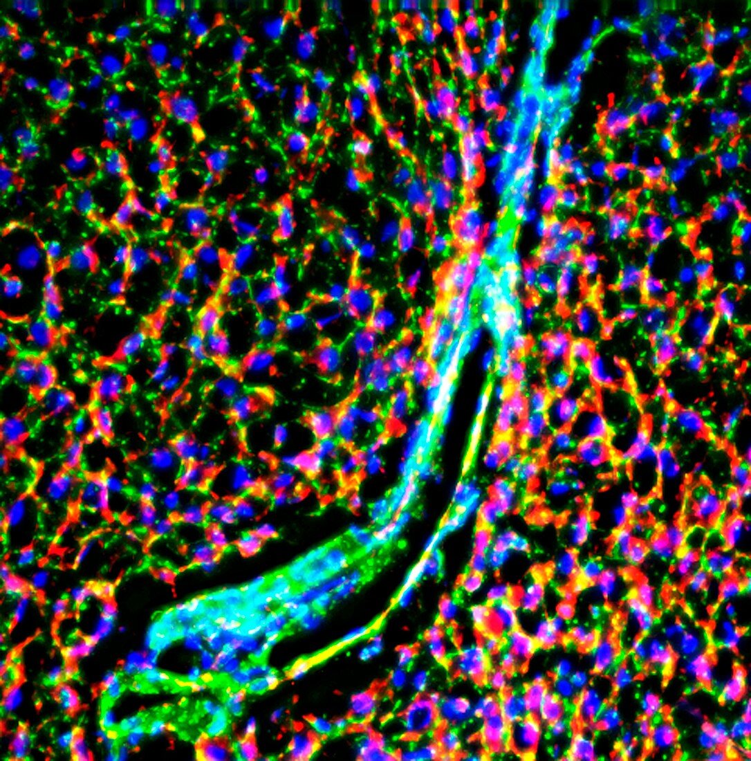 Rat liver,fluorescence micrograph