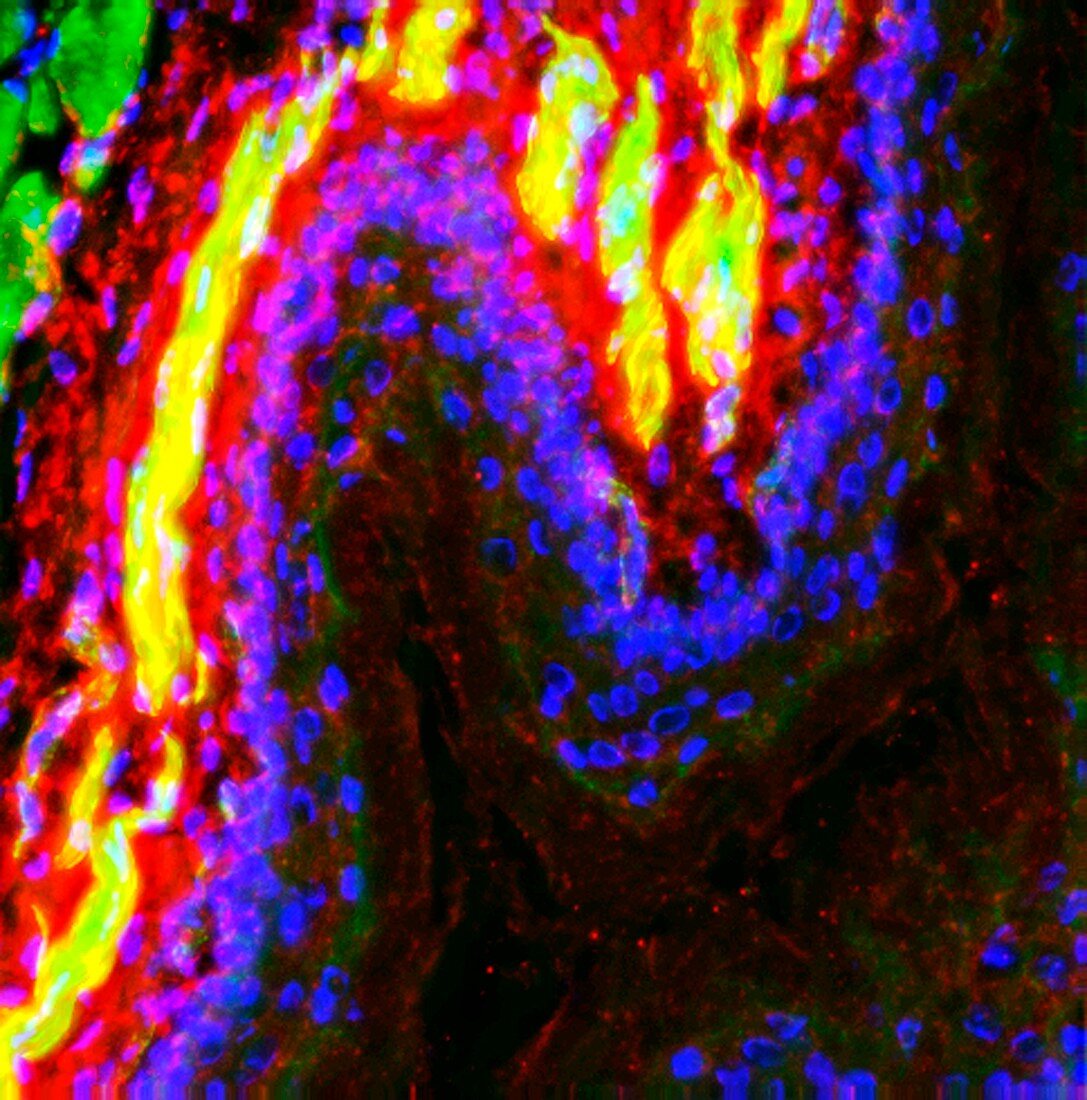 Rat oesophagus,fluorescence micrograph