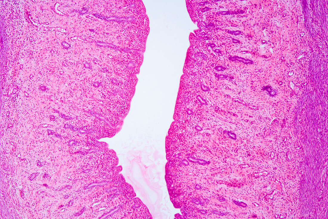 Cross-section of human vagina. LM