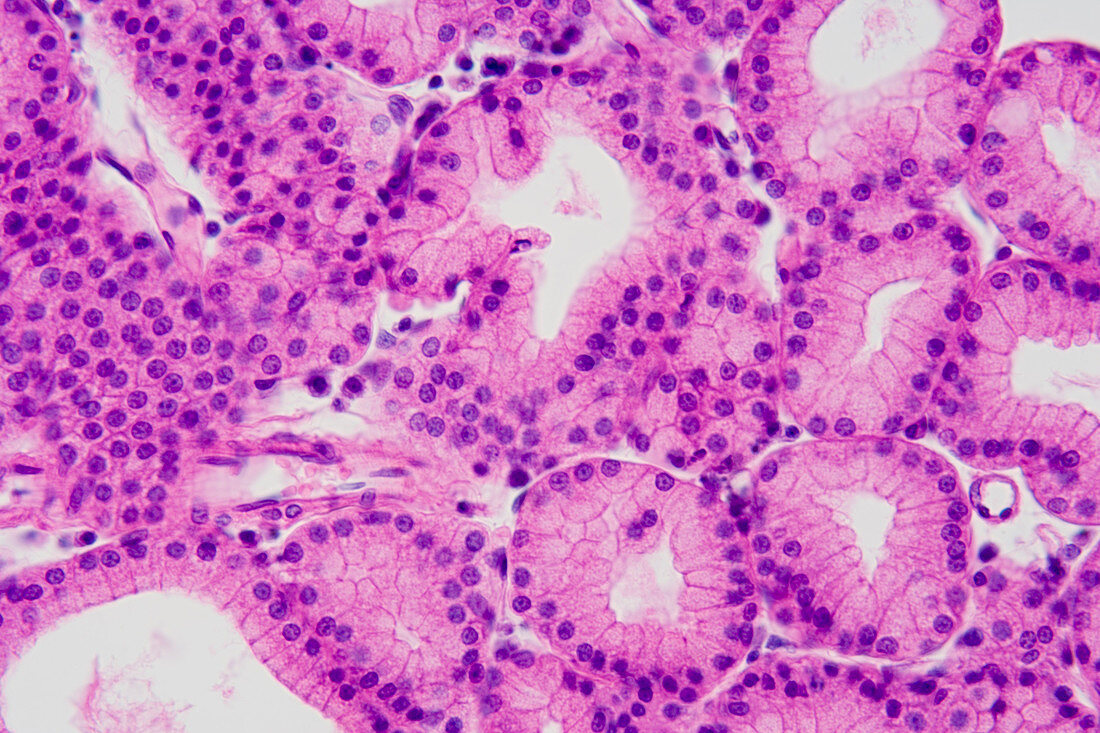 Cross-section of a lacrimal gland. LM
