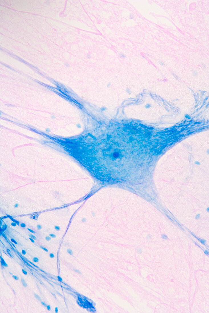 Giant Multipolar Neuron and glial cells