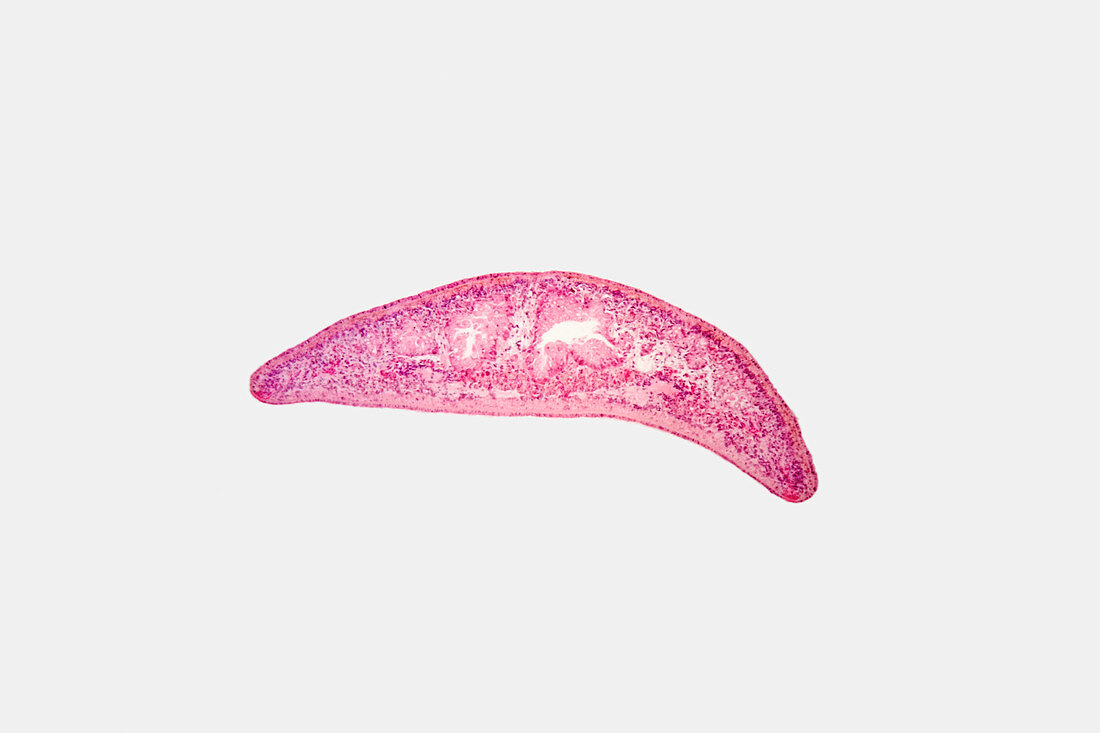Cross section of a Planaria flatworm