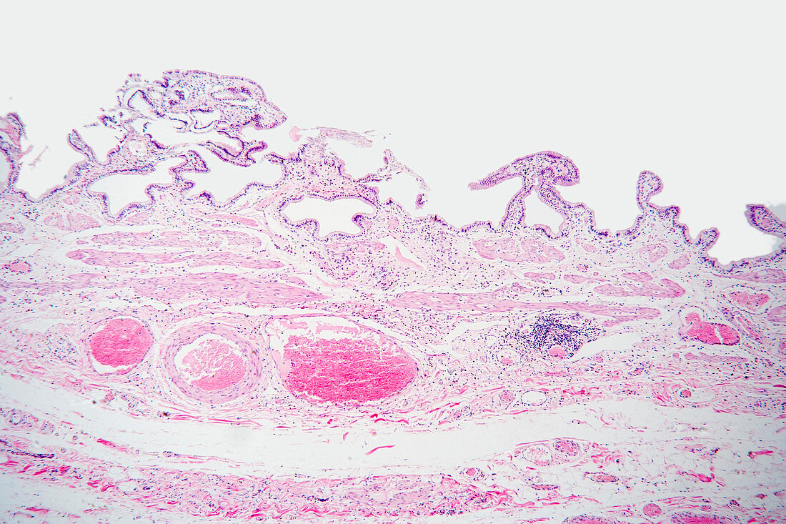 Human Gallbladder section LM X10