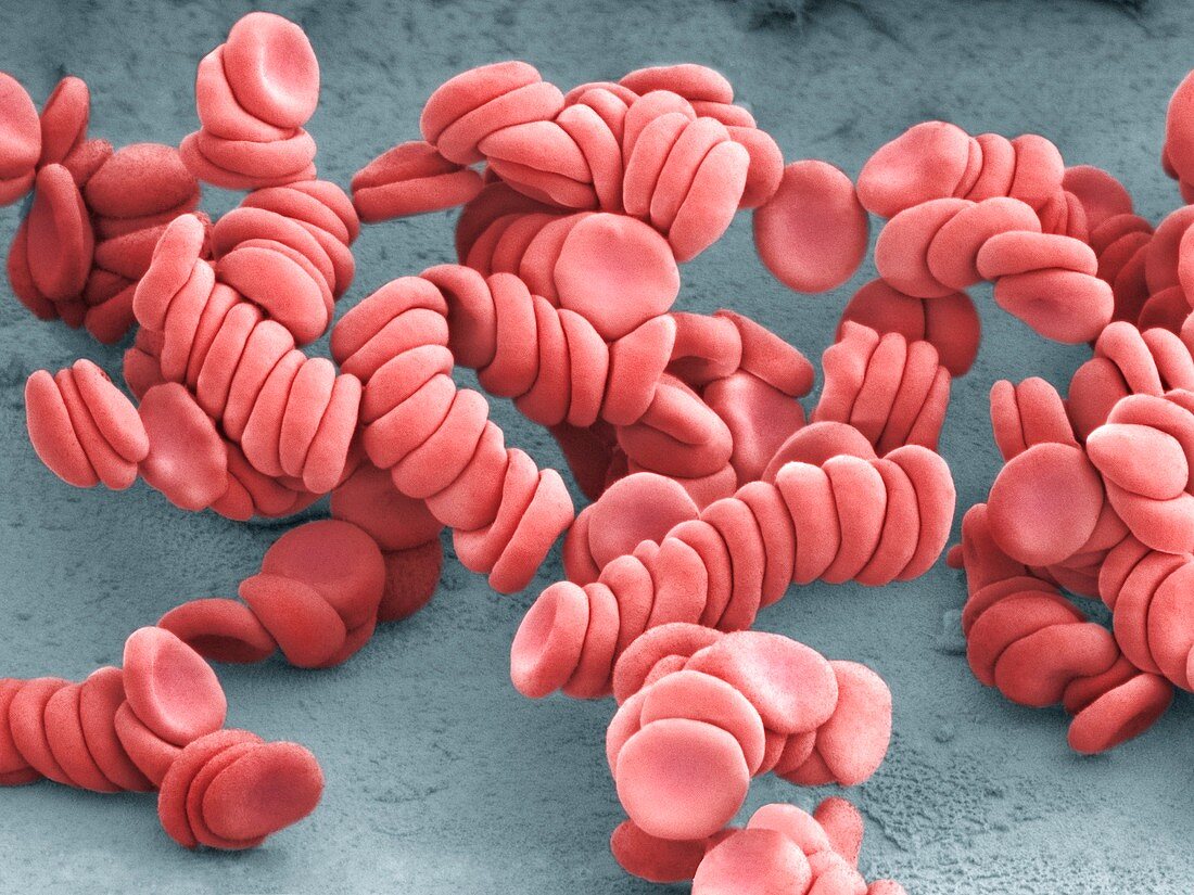 Stacked red blood cells,SEM