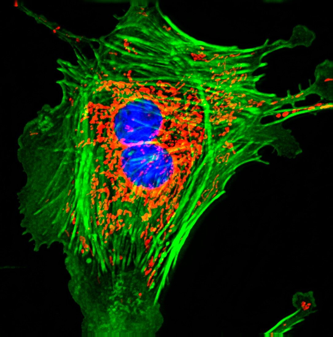 Pulmonary artery cells