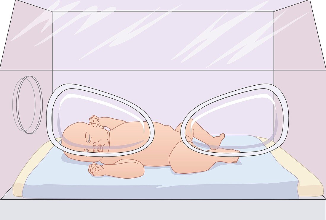 Baby in an incubator,artwork
