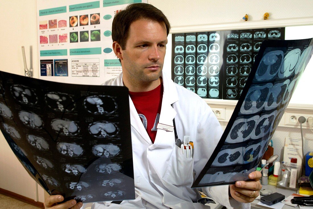 CT scanning diagnosis