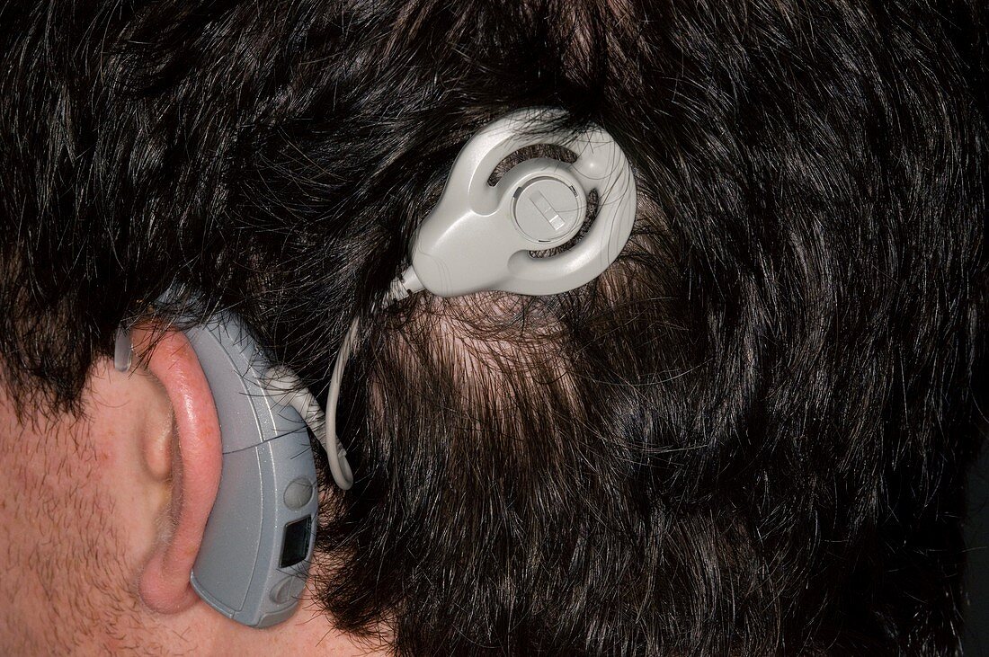 Auditory implant for hearing