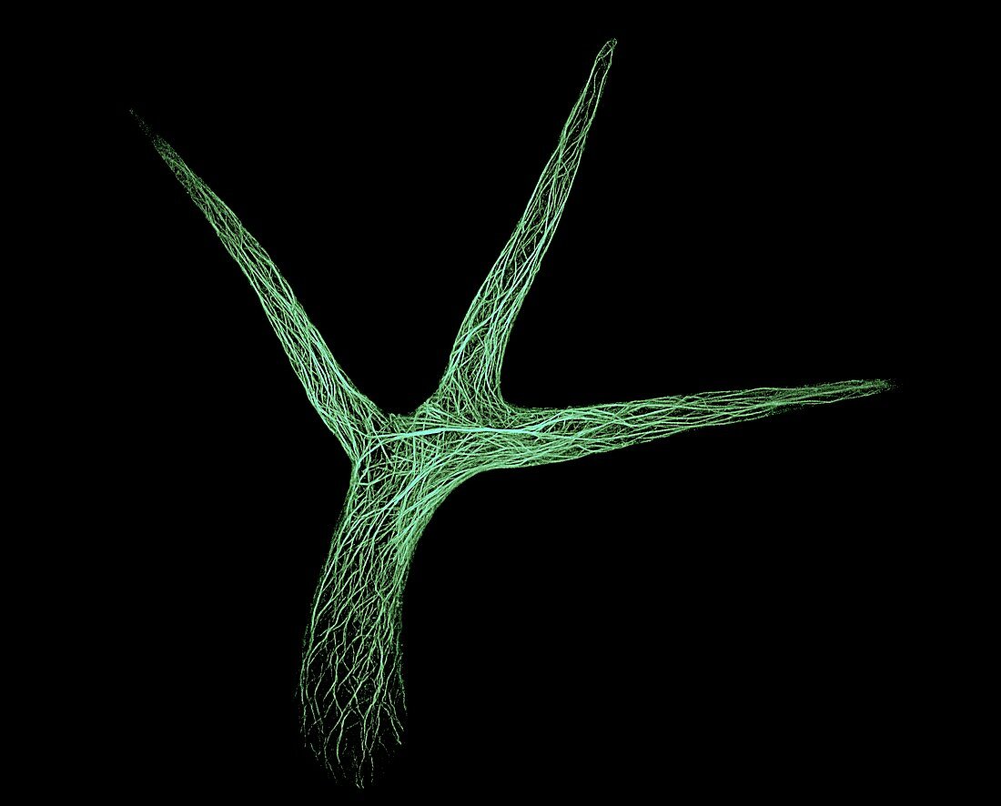 Thale cress leaf hair,micrograph