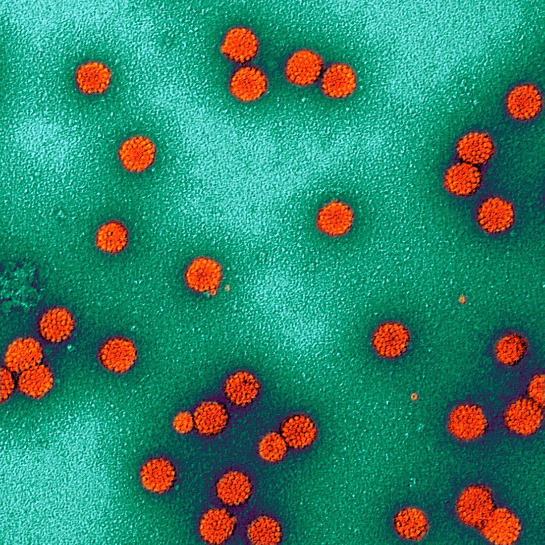 Human papillomavirus particles,TEM