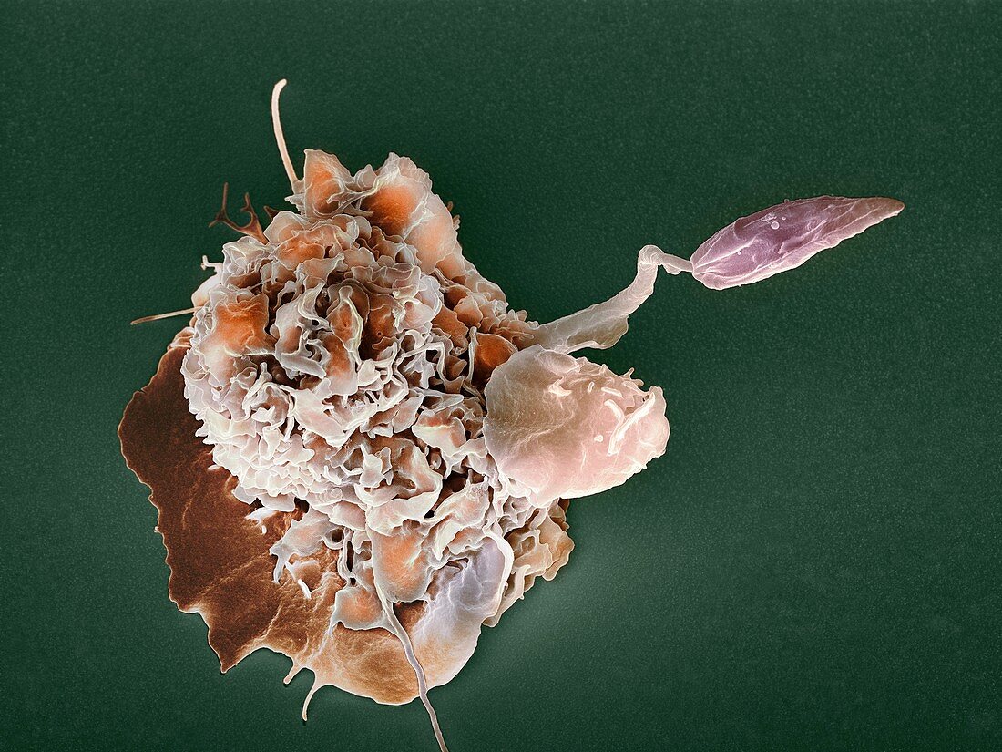 Macrophage attacking a foreign body,SEM