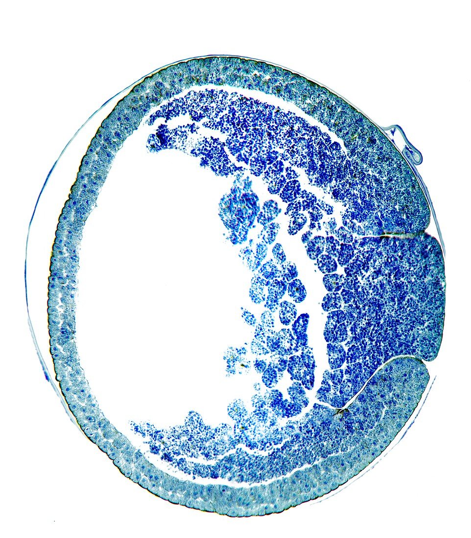 Developing frog egg,light micrograph