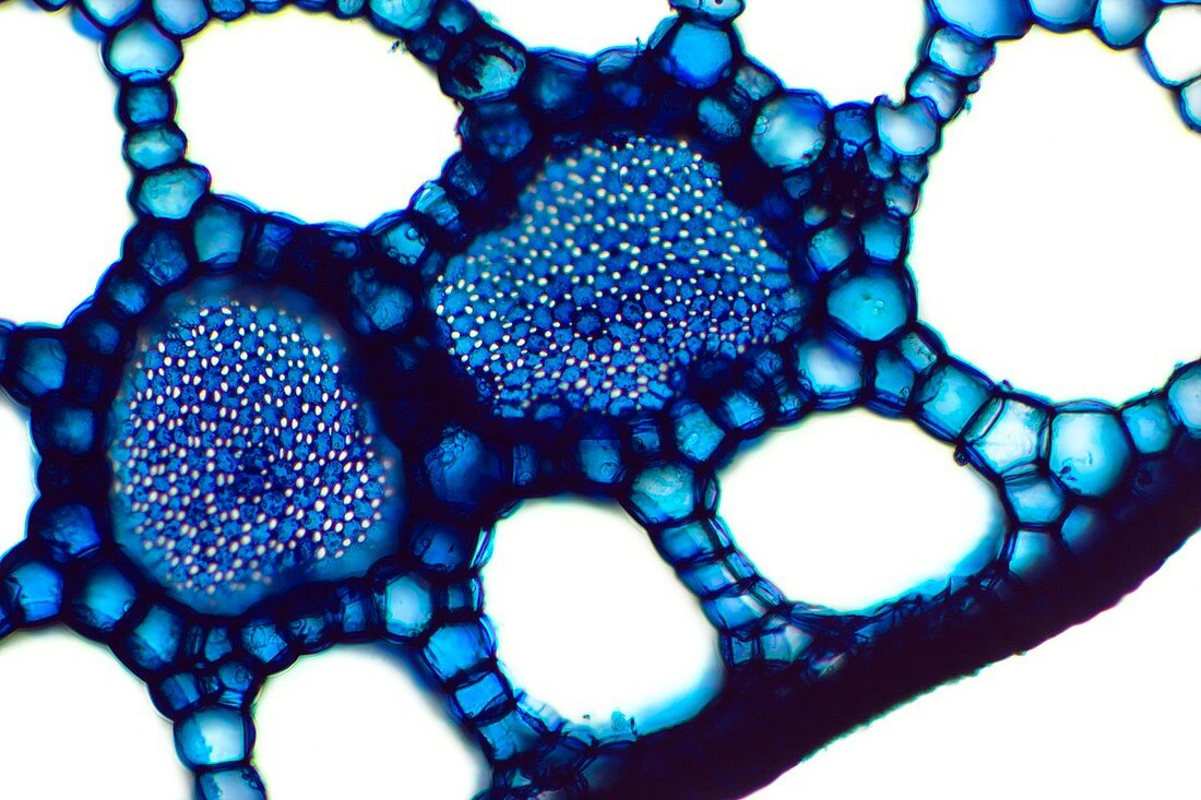 Water parsnip rhizome,light micrograph