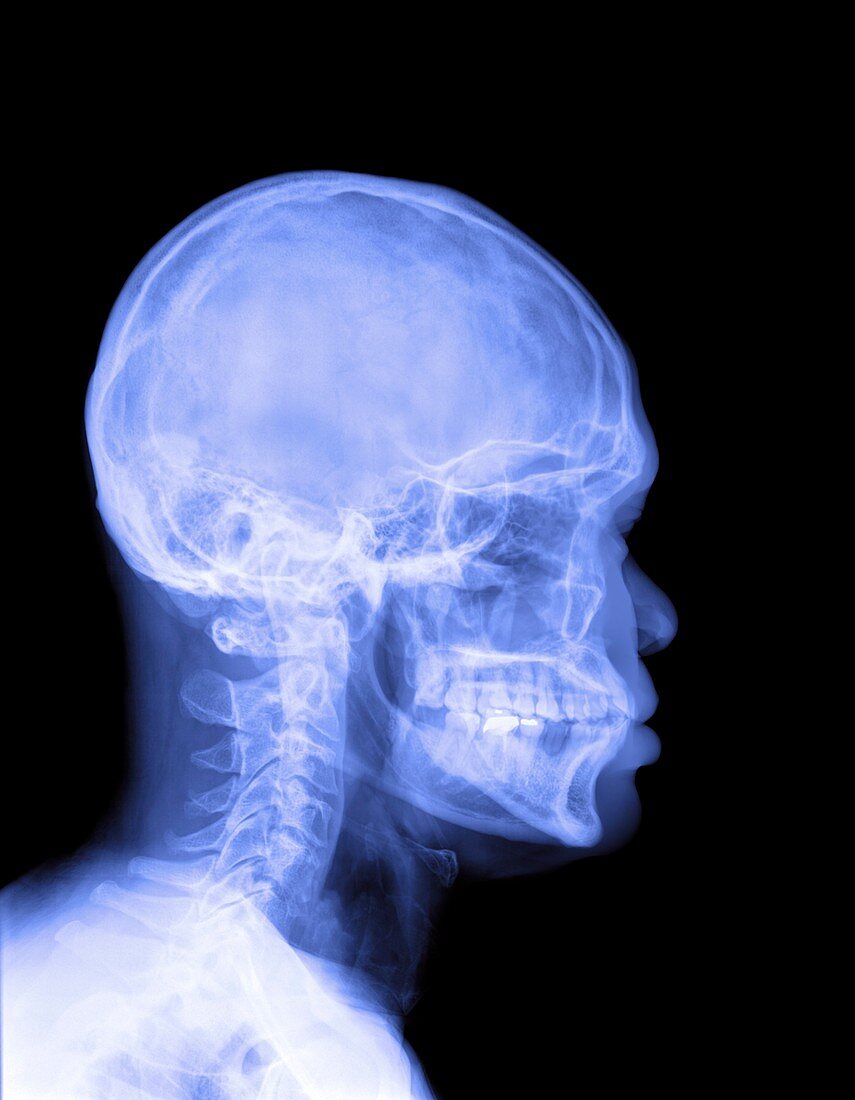Human head,X-ray