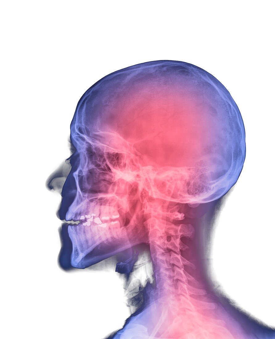 Human head,X-ray