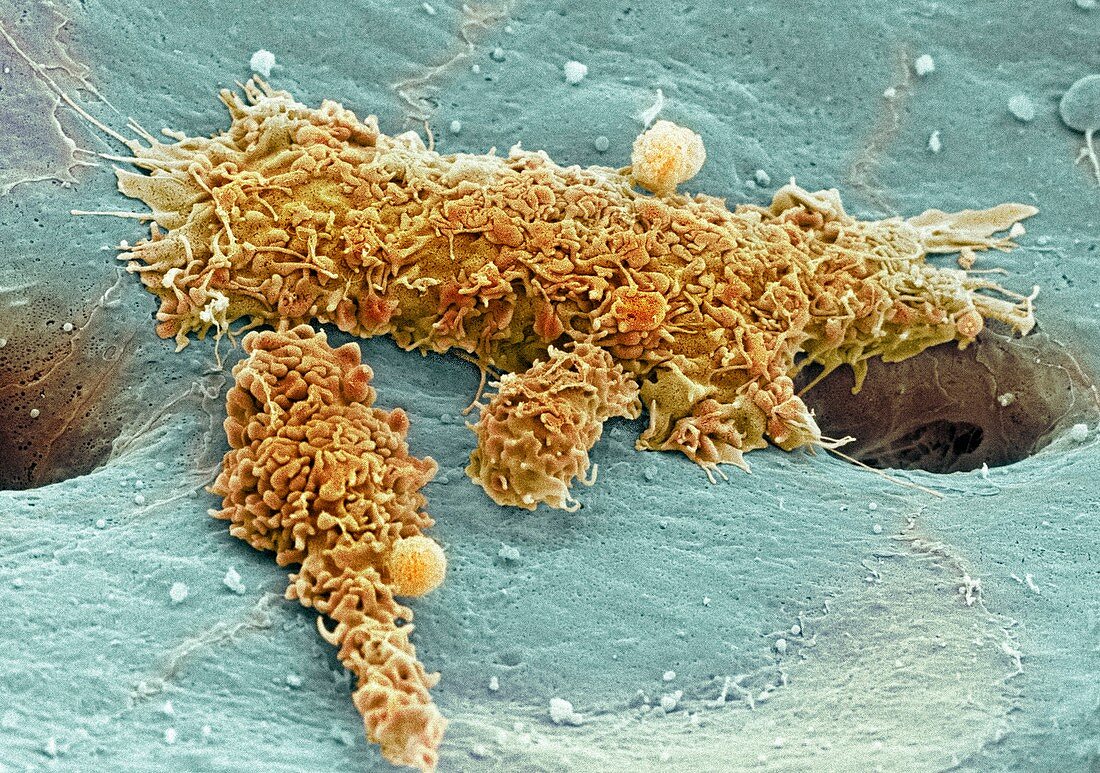 Liver macrophage cells,SEM