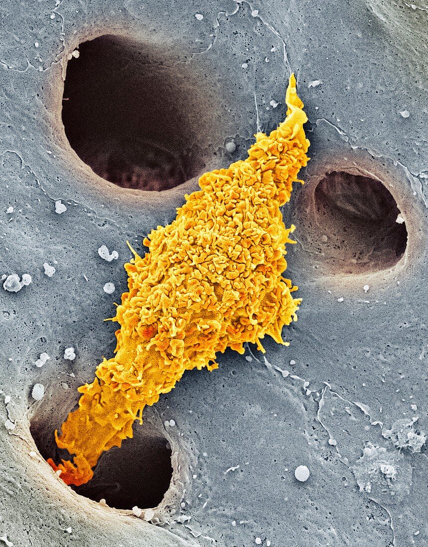 Liver macrophage cell,SEM
