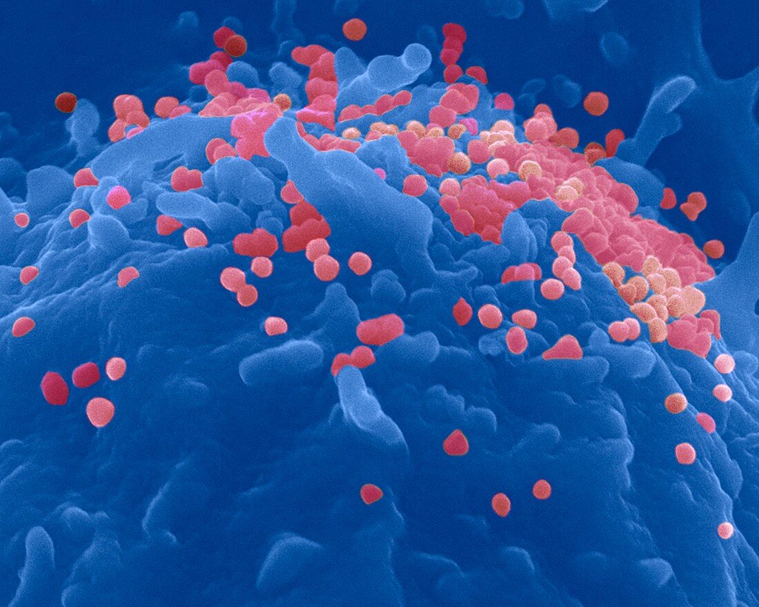 Budding HIV particles,SEM