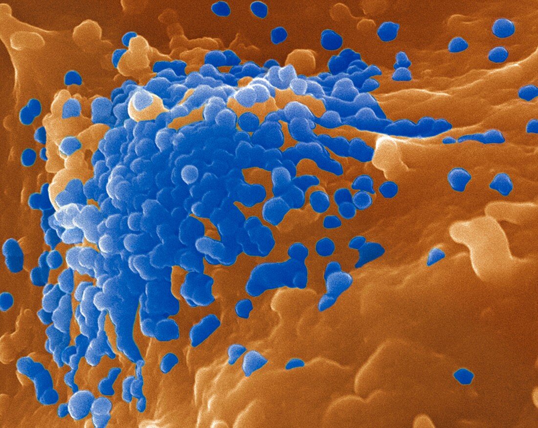 Budding HIV particles,SEM